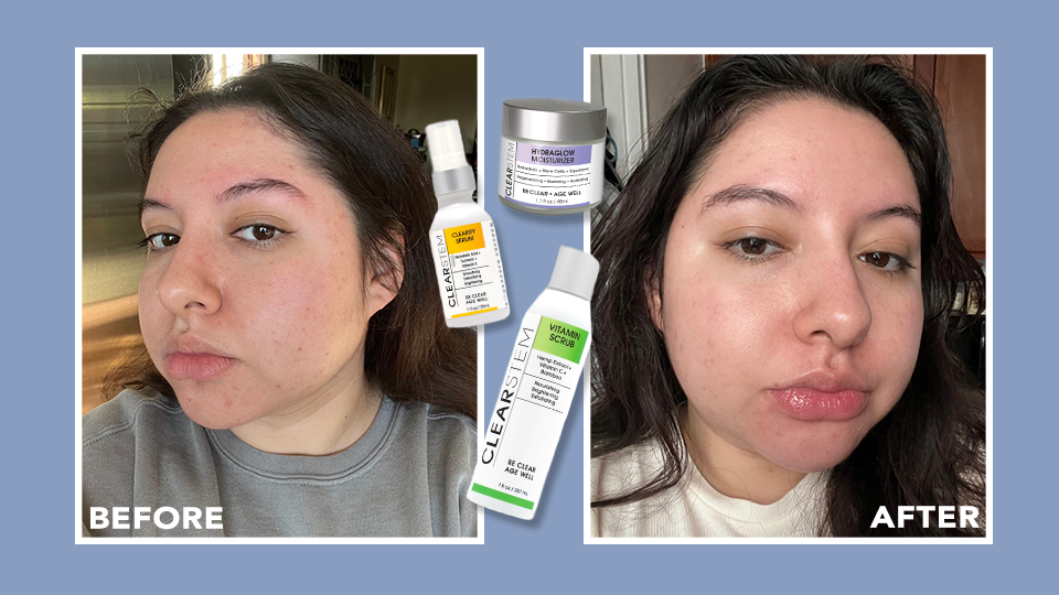 Clear Stem Skin Care